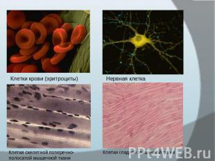 Клетки крови (эритроциты) Нервная клетка Клетки скелетной поперечно-полосатой мы