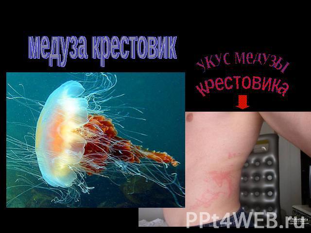 медуза крестовик укус медузы крестовика