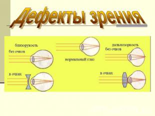 Дефекты зрения